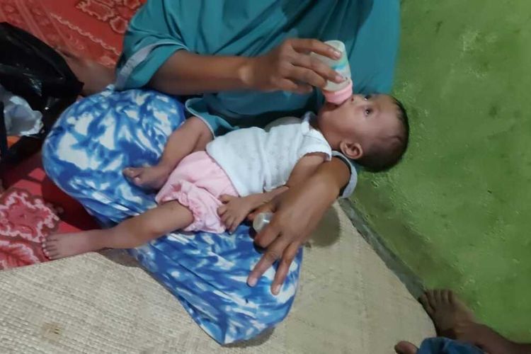 Asa seorang Ibu di Aceh Anaknya Derita Bocor Jantung